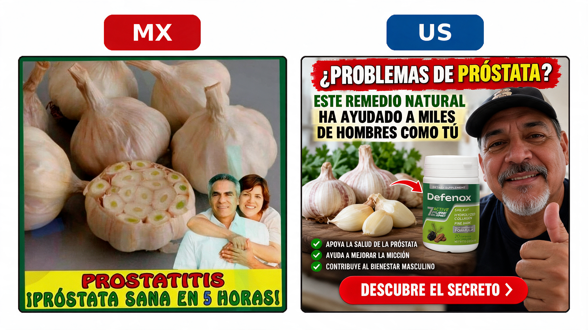 MX-vs-US-item001.png